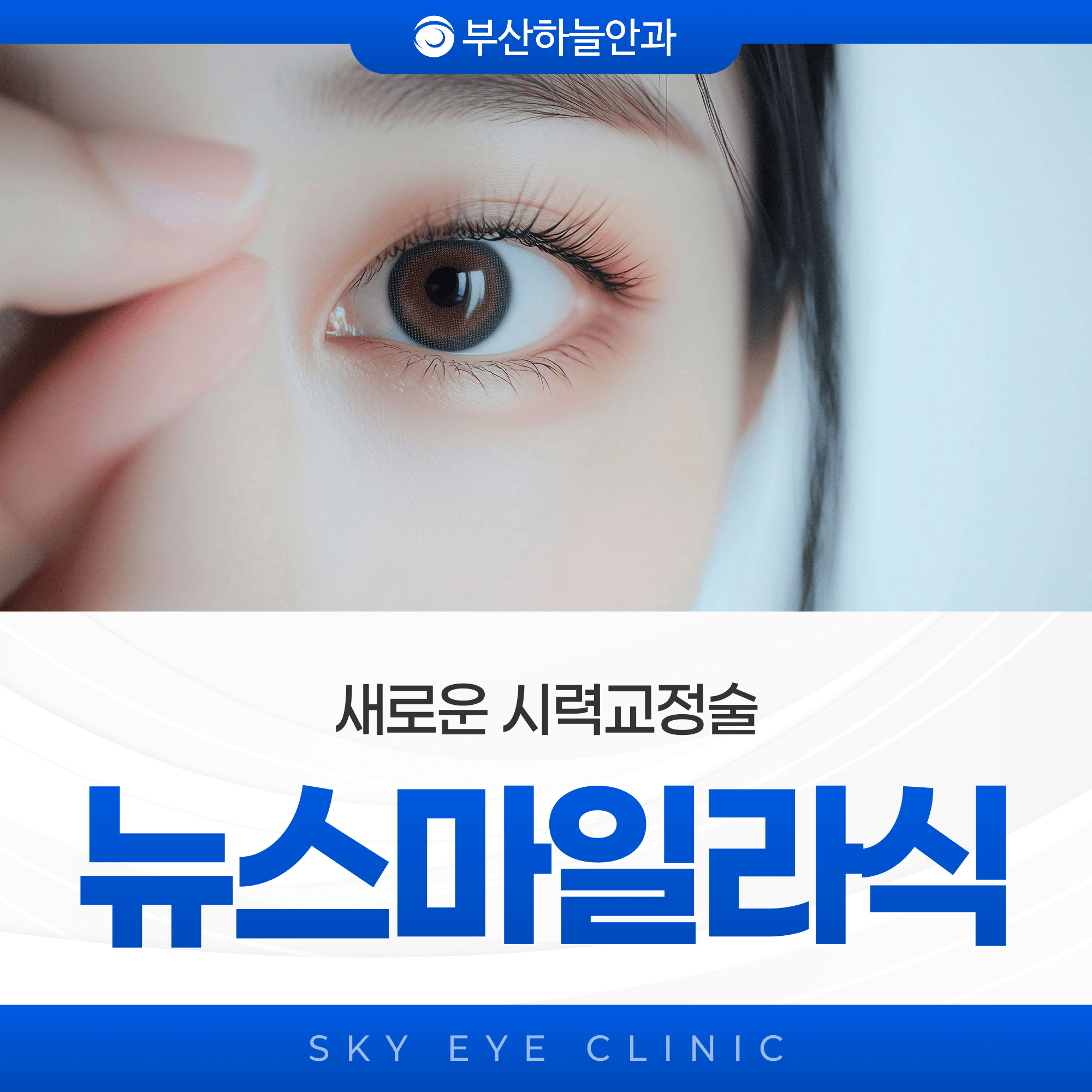 뉴스마일 라식이란? 라식·라섹 차이와 회복기간