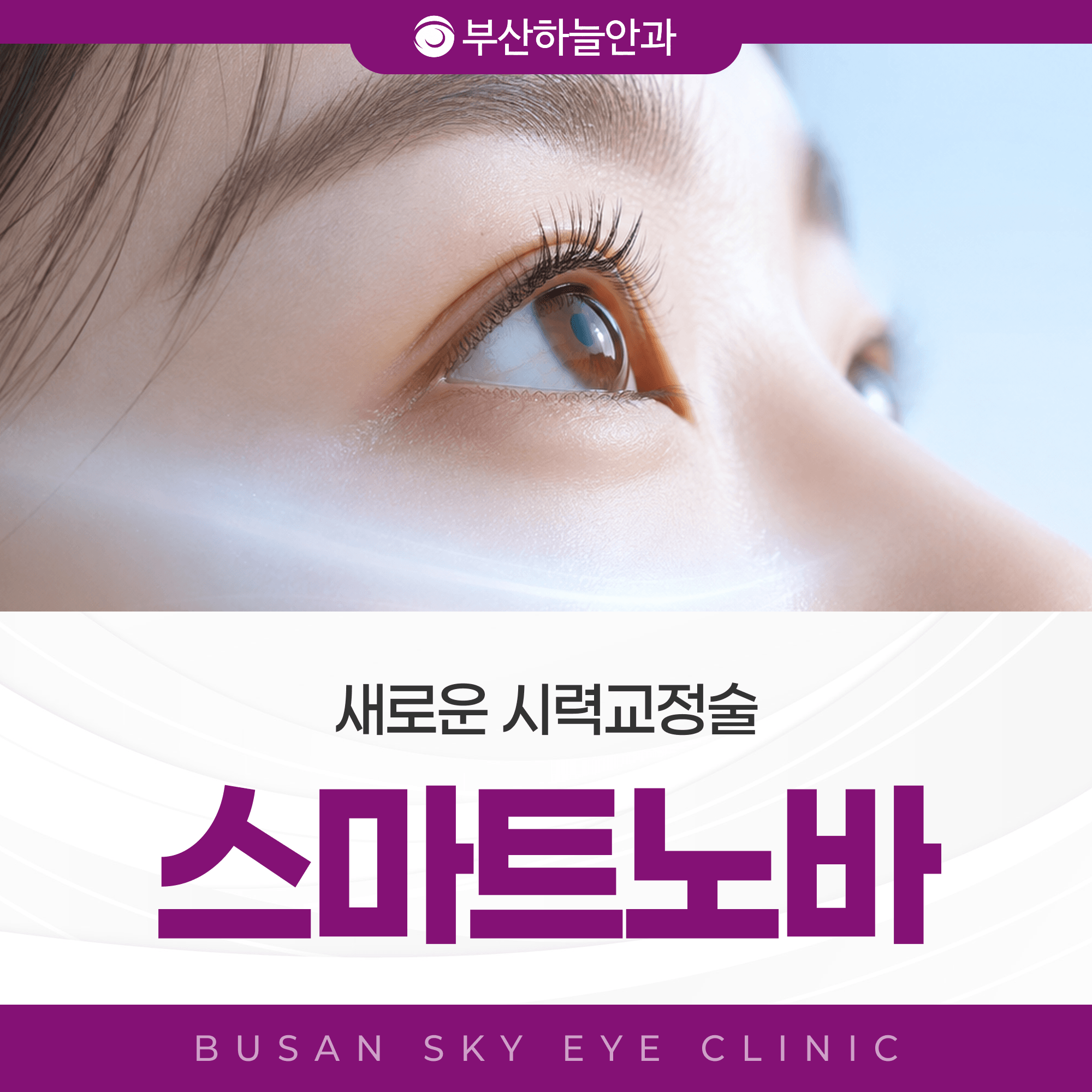 서면역안과 스마트노바 라식, 검사부터 경과관찰까지 일정 짜는 법