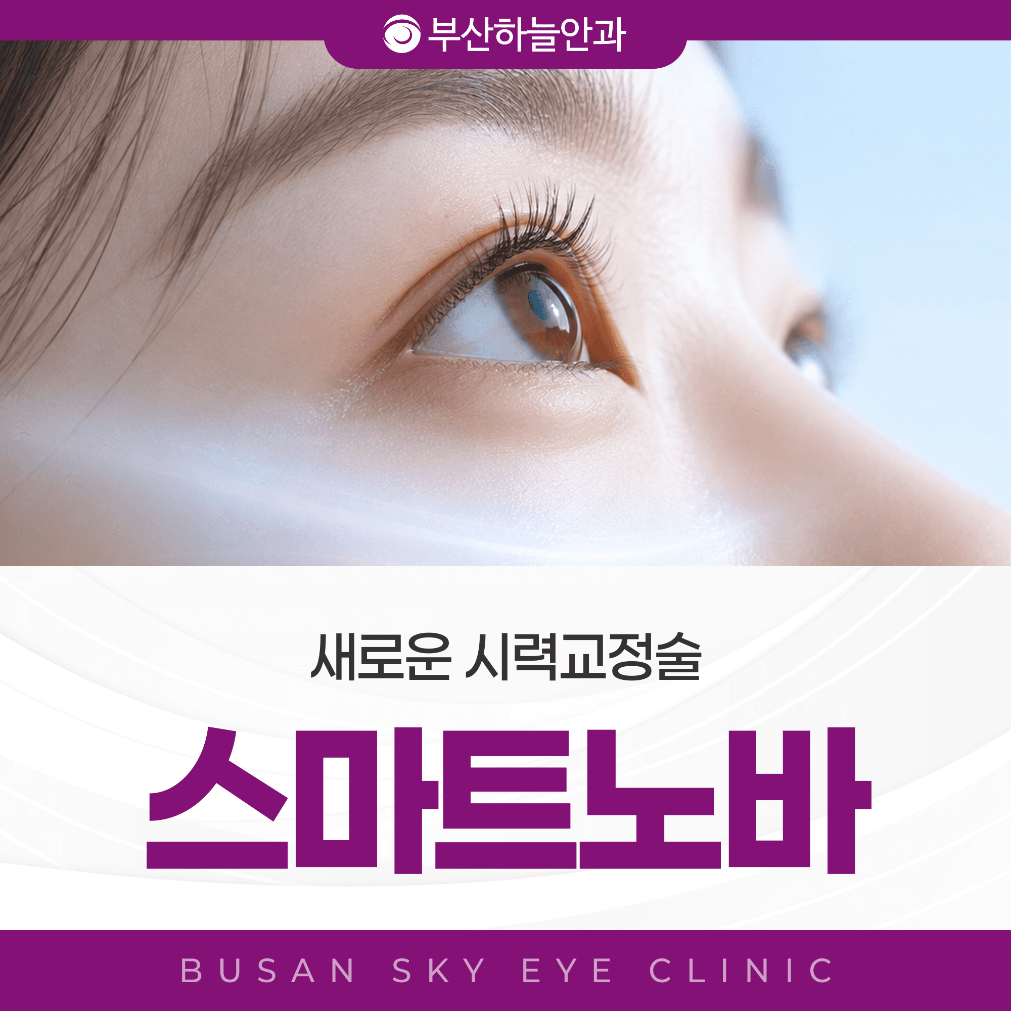 서면역안과 스마트노바 라식, 검사부터 경과관찰까지 일정 짜는 법