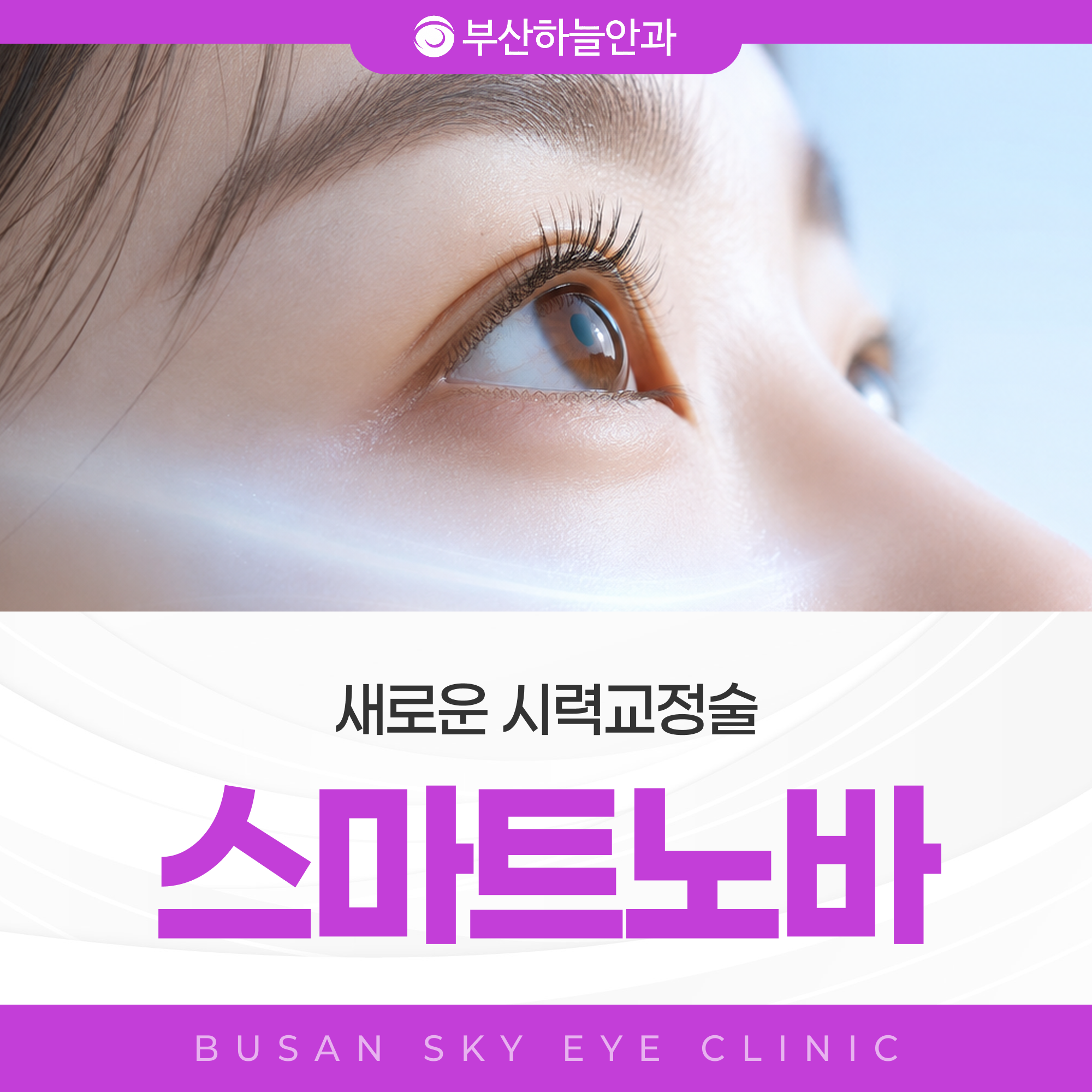 부산안과 스마트노바 라식 안내 이미지 1
