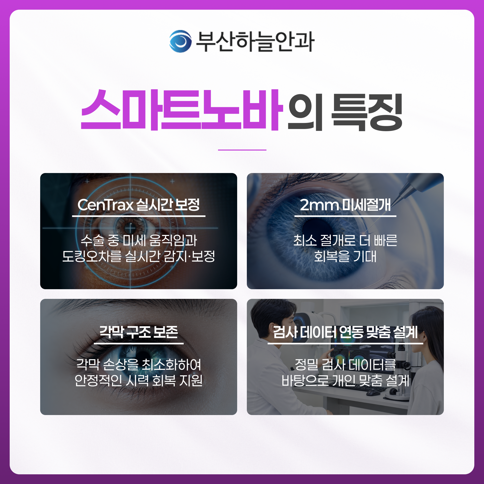 부산안과 스마트노바 라식 안내 이미지 3