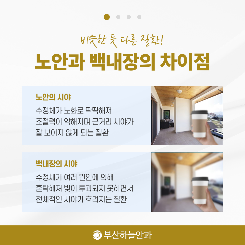 서면역안과추천 노안백내장 안내 이미지 2