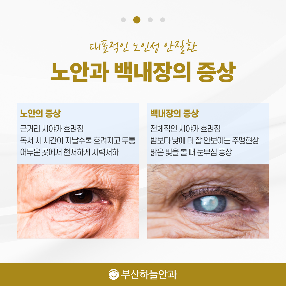 서면역안과추천 노안백내장 안내 이미지 3