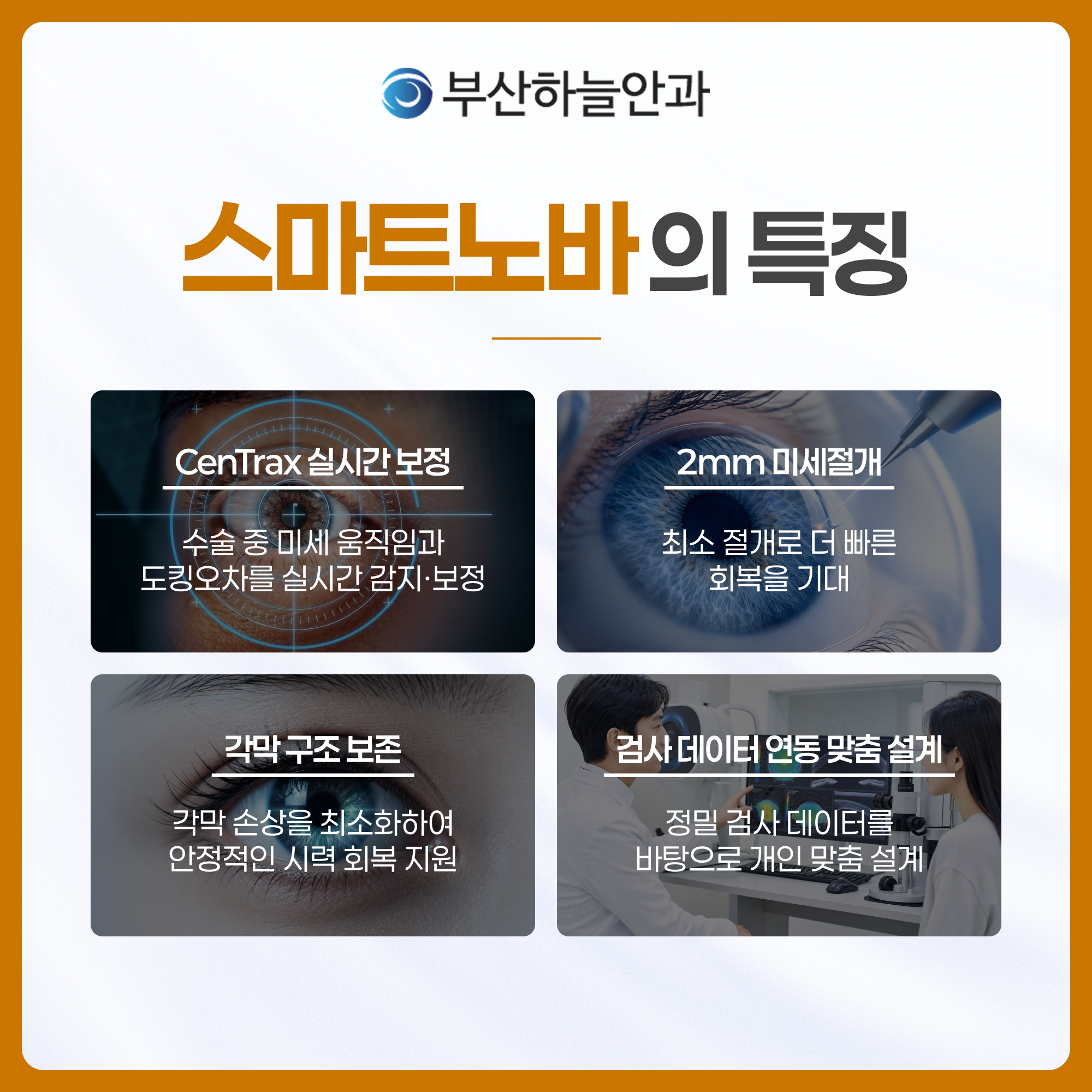 부산서면안과추천 스마트노바 라식 안내 이미지 3