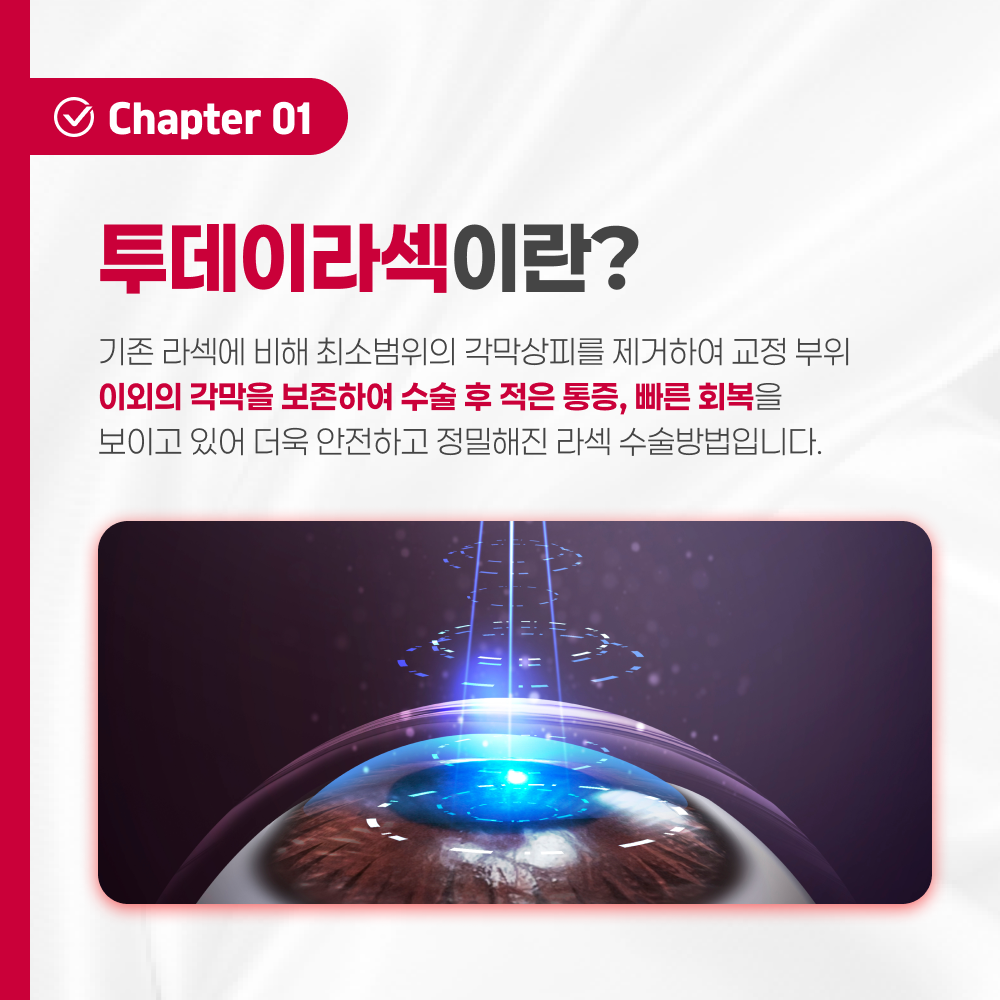 부산안과추천 투데이라섹 안내 이미지 2