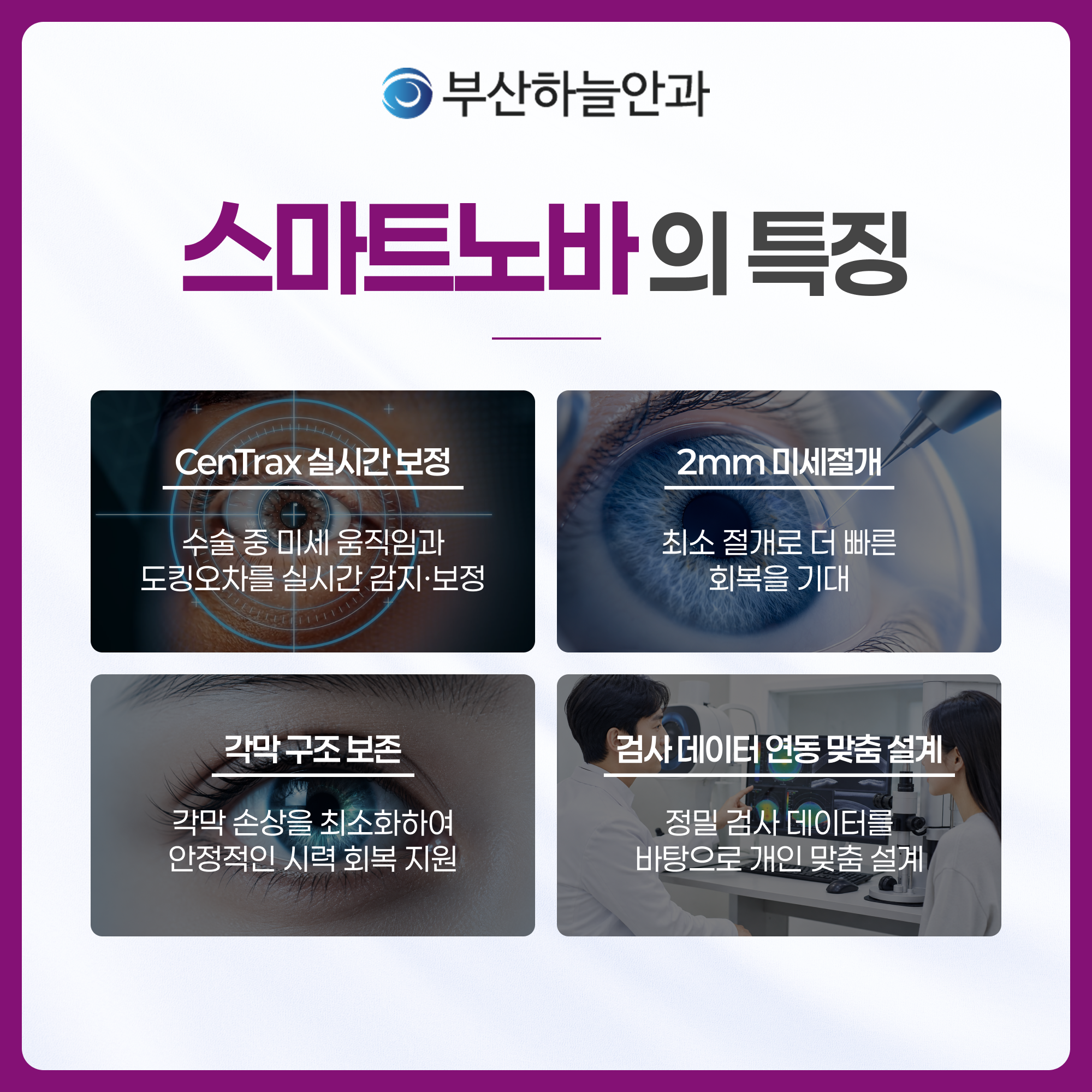 서면역안과 스마트노바 라식 안내 이미지 3