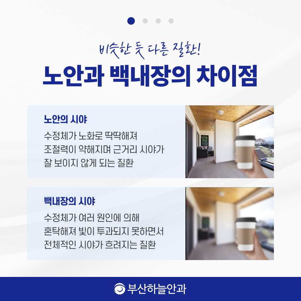 서면역안과 노안백내장 안내 이미지 2