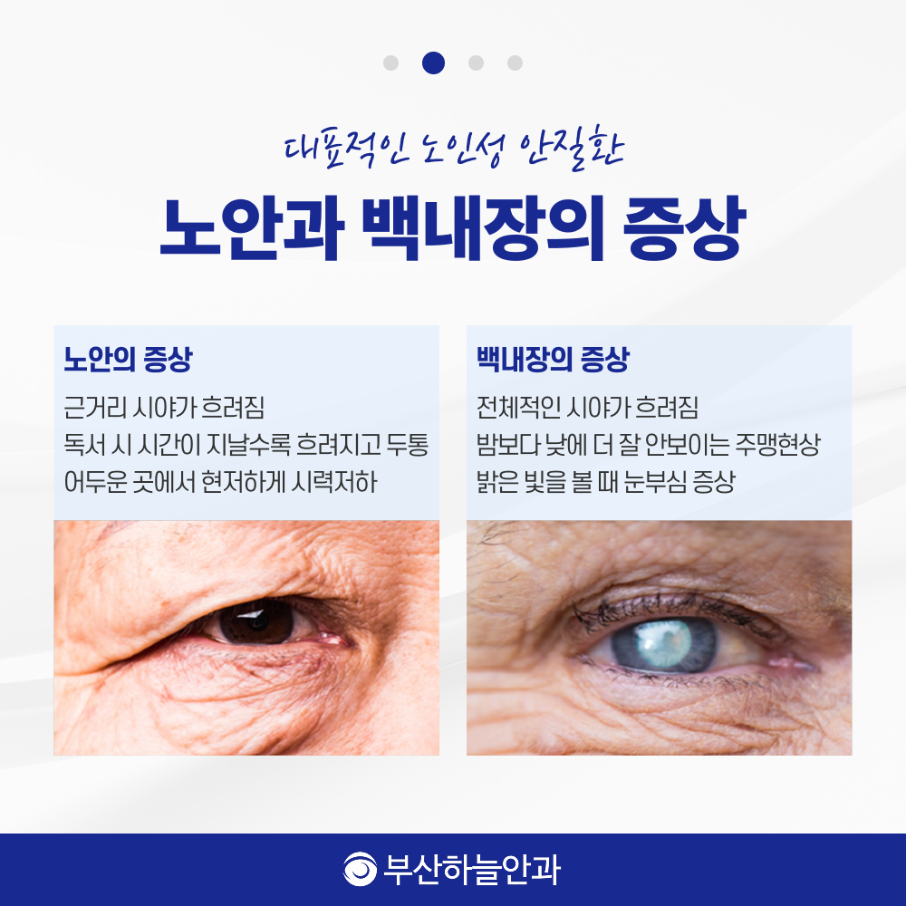 서면역안과 노안백내장 안내 이미지 3